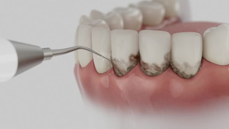 Trusted Emergency Dentist service in Williston, SC - Dentist Open Now